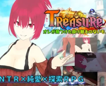 Treasure オレが見つけた掛け替えのないモノ